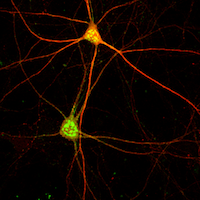 mouse cortical parvalbumin-positive fast-spiking interneuron
